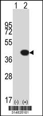 Western blot analysis of his-tag HEMK1 (arrow) using his tag antibody. 293 cell lysates (2 ug/lane) either nontransfected (Lane 1) or transiently transfected with the HEMK1 gene.