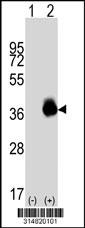 Western blot analysis of his-tag PDLIM4 (arrow) using his tag antibody. 293 cell lysates (2 ug/lane) either nontransfected (Lane 1) or transiently transfected with the PDLIM4 gene.