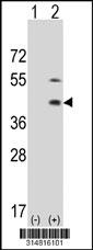 Western blot analysis of his-tag B3GAT3 (arrow) using his tag antibody. 293 cell lysates (2 ug/lane) either nontransfected (Lane 1) or transiently transfected with the B3GAT3 gene.