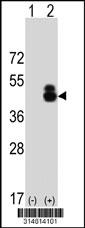 Western blot analysis of his-tag ST3GAL4 (arrow) using his tag antibody. 293 cell lysates (2 ug/lane) either nontransfected (Lane 1) or transiently transfected with the ST3GAL4 gene.
