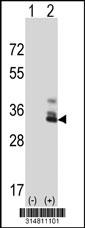 Western blot analysis of his-tag FAM83F (arrow) using his tag antibody. 293 cell lysates (2 ug/lane) either nontransfected (Lane 1) or transiently transfected with the FAM83F gene.
