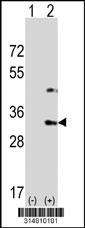 Western blot analysis of his-tag RCN1 (arrow) using his tag antibody. 293 cell lysates (2 ug/lane) either nontransfected (Lane 1) or transiently transfected with the RCN1 gene.