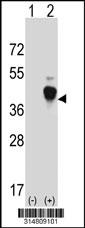 Western blot analysis of his-tag CCDC92 (arrow) using his tag antibody. 293 cell lysates (2 ug/lane) either nontransfected (Lane 1) or transiently transfected with the CCDC92 gene.