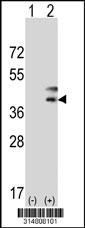 Western blot analysis of his-tag TRUB2 (arrow) using his tag antibody. 293 cell lysates (2 ug/lane) either nontransfected (Lane 1) or transiently transfected with the TRUB2 gene.