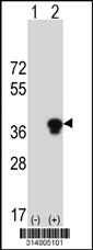 Western blot analysis of his-tag PLSCR4 (arrow) using his tag antibody. 293 cell lysates (2 ug/lane) either nontransfected (Lane 1) or transiently transfected with the PLSCR4 gene.