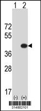 Western blot analysis of his-tag B4GALT7 (arrow) using his tag antibody. 293 cell lysates (2 ug/lane) either nontransfected (Lane 1) or transiently transfected with the B4GALT7 gene.