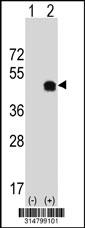 Western blot analysis of his-tag RCN3 (arrow) using his tag antibody. 293 cell lysates (2 ug/lane) either nontransfected (Lane 1) or transiently transfected with the RCN3 gene.