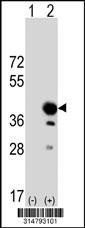 Western blot analysis of his-tag FAM50B (arrow) using his tag antibody. 293 cell lysates (2 ug/lane) either nontransfected (Lane 1) or transiently transfected with the FAM50B gene.
