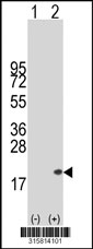 Western blot analysis of his-tag LGALS14 (arrow) using his tag antibody. 293T cell lysates (2 ug/lane) either nontransfected (Lane 1) or transiently transfected with the LGALS14 gene‘