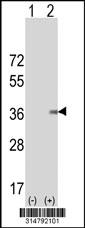 Western blot analysis of his-tag SLC39A1 (arrow) using his tag antibody. 293 cell lysates (2 ug/lane) either nontransfected (Lane 1) or transiently transfected with the SLC39A1 gene.
