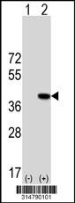 Western blot analysis of his-tag PPP2R4 (arrow) using his tag antibody. 293 cell lysates (2 ug/lane) either nontransfected (Lane 1) or transiently transfected with the PPP2R4 gene.