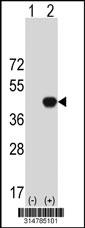 Western blot analysis of his-tag LRRC46 (arrow) using his tag antibody. 293 cell lysates (2 ug/lane) either nontransfected (Lane 1) or transiently transfected with the LRRC46 gene.