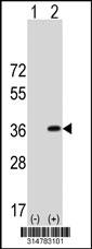 Western blot analysis of his-tag PYCR2 (arrow) using his tag antibody. 293 cell lysates (2 ug/lane) either nontransfected (Lane 1) or transiently transfected with the PYCR2 gene.