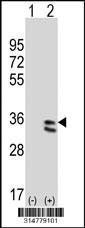 Western blot analysis of his-tag RDH5 (arrow) using his tag antibody. 293 cell lysates (2 ug/lane) either nontransfected (Lane 1) or transiently transfected with the RDH5 gene.
