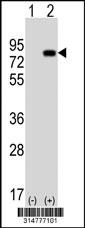 Western blot analysis of his-tag SFRS4 (arrow) using his tag antibody. 293 cell lysates (2 ug/lane) either nontransfected (Lane 1) or transiently transfected with the SFRS4 gene.