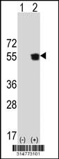 Western blot analysis of his-tag MINPP1 (arrow) using his tag antibody. 293 cell lysates (2 ug/lane) either nontransfected (Lane 1) or transiently transfected with the MINPP1 gene.