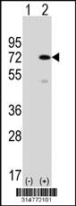 Western blot analysis of his-tag TULP1 (arrow) using his tag antibody. 293 cell lysates (2 ug/lane) either nontransfected (Lane 1) or transiently transfected with the TULP1 gene.