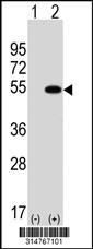 Western blot analysis of his-tag BRUNOL5 (arrow) using his tag antibody. 293 cell lysates (2 ug/lane) either nontransfected (Lane 1) or transiently transfected with the BRUNOL5 gene.