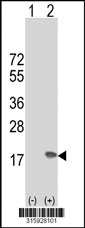 Western blot analysis of his-tag POLR2J (arrow) using his tag antibody. 293T cell lysates (2 ug/lane) either nontransfected (Lane 1) or transiently transfected with the POLR2J gene‘