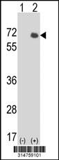 Western blot analysis of his-tag GTF2A1L (arrow) using his tag antibody. 293 cell lysates (2 ug/lane) either nontransfected (Lane 153) or transiently transfected with theGTF2A1L gene.