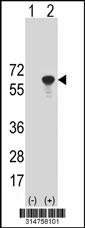 Western blot analysis of his-tag IKZF1 (arrow) using his tag antibody. 293 cell lysates (2 ug/lane) either nontransfected (Lane 139) or transiently transfected with theIKZF1 gene.