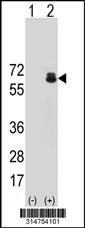Western blot analysis of his-tag TFEB (arrow) using his tag antibody. 293 cell lysates (2 ug/lane) either nontransfected (Lane 183) or transiently transfected with theTFEB gene.