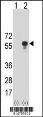 Western blot analysis of his-tag NARFL (arrow) using his tag antibody. 293 cell lysates (2 ug/lane) either nontransfected (Lane 172) or transiently transfected with theNARFL gene.