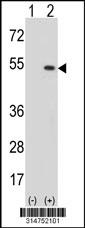 Western blot analysis of his-tag CAP1 (arrow) using his tag antibody. 293 cell lysates (2 ug/lane) either nontransfected (Lane 107) or transiently transfected with theCAP1 gene.