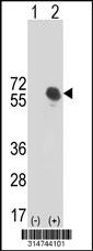 Western blot analysis of his-tag ST6GALNAC1 (arrow) using his tag antibody. 293 cell lysates (2 ug/lane) either nontransfected (Lane 146) or transiently transfected with theST6GALNAC1 gene.