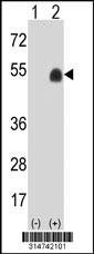 Western blot analysis of his-tag CFP (arrow) using his tag antibody. 293 cell lysates (2 ug/lane) either nontransfected (Lane 124) or transiently transfected with theCFP gene.