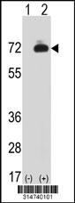 Western blot analysis of his-tag COQ6 (arrow) using his tag antibody. 293 cell lysates (2 ug/lane) either nontransfected (Lane 110) or transiently transfected with theCOQ6 gene.