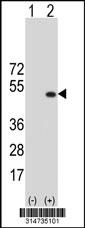 Western blot analysis of his-tag OXSM (arrow) using his tag antibody. 293 cell lysates (2 ug/lane) either nontransfected (Lane 55) or transiently transfected with theOXSM gene.