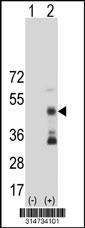 Western blot analysis of his-tag KIAA1430 (arrow) using his tag antibody. 293 cell lysates (2 ug/lane) either nontransfected (Lane 175) or transiently transfected with theKIAA1430 gene.