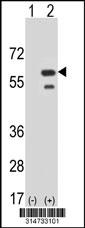 Western blot analysis of his-tag TINF2 (arrow) using his tag antibody. 293 cell lysates (2 ug/lane) either nontransfected (Lane 36) or transiently transfected with theTINF2 gene.