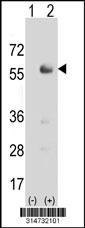 Western blot analysis of his-tag IRF3 (arrow) using his tag antibody. 293 cell lysates (2 ug/lane) either nontransfected (Lane 69) or transiently transfected with theIRF3 gene.