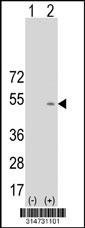 Western blot analysis of his-tag METT11D1 (arrow) using his tag antibody. 293 cell lysates (2 ug/lane) either nontransfected (Lane 37) or transiently transfected with theMETT11D1 gene.