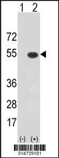 Western blot analysis of his-tag PSG3 (arrow) using his tag antibody. 293 cell lysates (2 ug/lane) either nontransfected (Lane 42) or transiently transfected with thePSG3 gene.