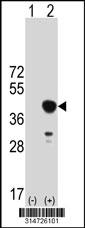 Western blot analysis of his-tag CD79A (arrow) using his tag antibody. 293 cell lysates (2 ug/lane) either nontransfected (Lane 1) or transiently transfected with the CD79A gene.