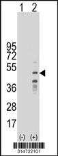 Western blot analysis of his-tag RBMY1F (arrow) using his tag antibody. 293 cell lysates (2 ug/lane) either nontransfected (Lane 171) or transiently transfected with theRBMY1F gene.