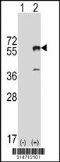 Western blot analysis of his-tag ADC (arrow) using his tag antibody. 293 cell lysates (2 ug/lane) either nontransfected (Lane 1) or transiently transfected with the ADC gene.
