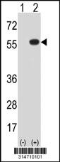 Western blot analysis of his-tag TMPRSS6 (arrow) using his tag antibody. 293 cell lysates (2 ug/lane) either nontransfected (Lane 203) or transiently transfected with theTMPRSS6 gene.