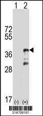 Western blot analysis of his-tag WDR41 (arrow) using his tag antibody. 293 cell lysates (2 ug/lane) either nontransfected (Lane 1) or transiently transfected with the WDR41 gene.