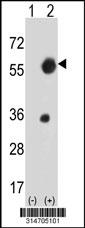 Western blot analysis of his-tag KIAA1609 (arrow) using his tag antibody. 293 cell lysates (2 ug/lane) either nontransfected (Lane 148) or transiently transfected with theKIAA1609 gene.