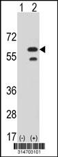 Western blot analysis of his-tag SYTL1 (arrow) using his tag antibody. 293 cell lysates (2 ug/lane) either nontransfected (Lane 125) or transiently transfected with theSYTL1 gene.