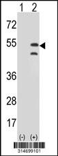 Western blot analysis of his-tag TIMM44 (arrow) using his tag antibody. 293 cell lysates (2 ug/lane) either nontransfected (Lane 186) or transiently transfected with theTIMM44 gene.
