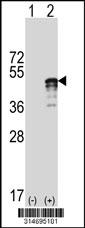 Western blot analysis of his-tag FBXO39 (arrow) using his tag antibody. 293 cell lysates (2 ug/lane) either nontransfected (Lane 1) or transiently transfected with the FBXO39 gene.