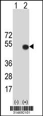 Western blot analysis of his-tag ADAMTSL1 (arrow) using his tag antibody. 293 cell lysates (2 ug/lane) either nontransfected (Lane 173) or transiently transfected with theADAMTSL1 gene.