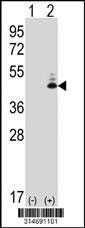 Western blot analysis of his-tag FGL2 (arrow) using his tag antibody. 293 cell lysates (2 ug/lane) either nontransfected (Lane 1) or transiently transfected with the FGL2 gene.