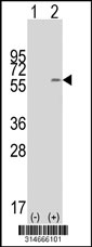 Western blot analysis of his-tag PIGM (arrow) using his tag antibody. 293T cell lysates (2 ug/lane) either nontransfected (Lane 1) or transiently transfected with the PIGM gene‘