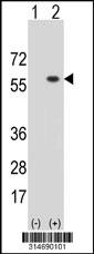 Western blot analysis of his-tag LILRA3 (arrow) using his tag antibody. 293 cell lysates (2 ug/lane) either nontransfected (Lane 164) or transiently transfected with theLILRA3 gene.